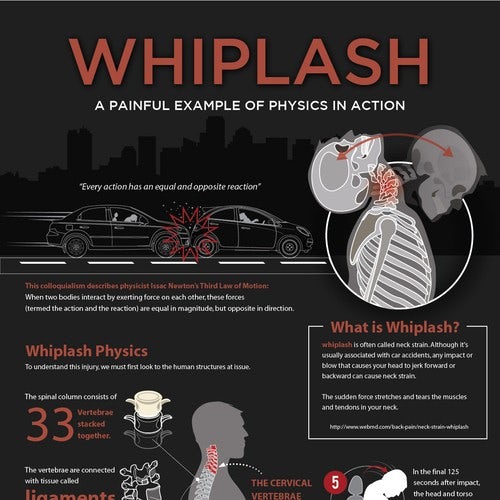  Инфографика Whiplash "width =" 500 "height =" 500 "/> 
 
<figcaption> Инфографика от FritzR </figcaption></figure>
<h2><span id=